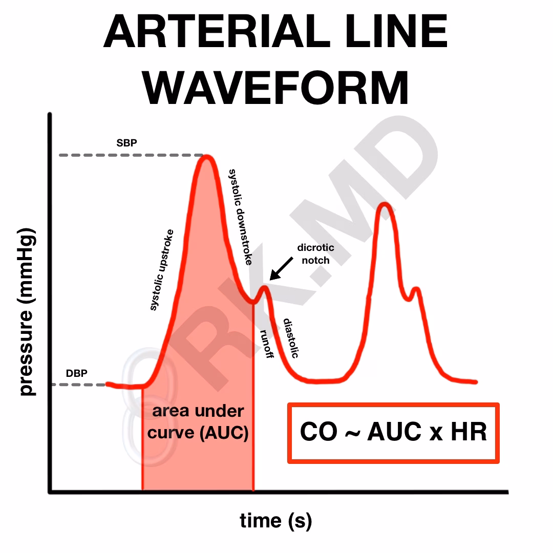 Pressure Transducers And Arterial Line Waveforms