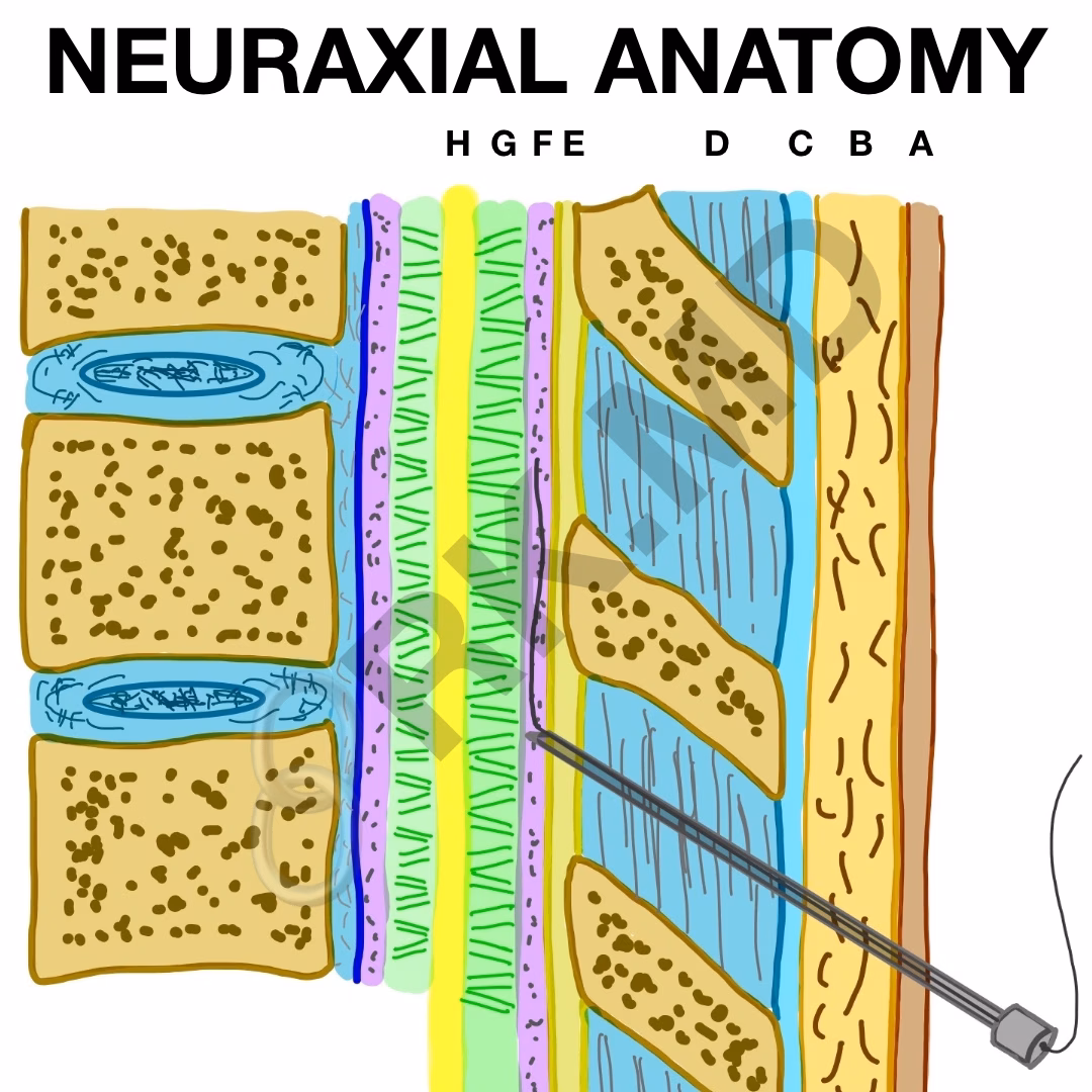 Neuraxial Anesthetics And Anatomy
