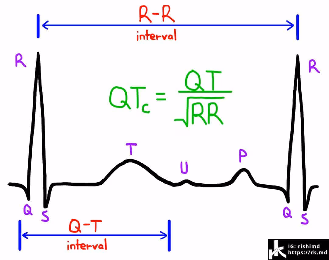“Is This ECG Real Or Artifact?”
