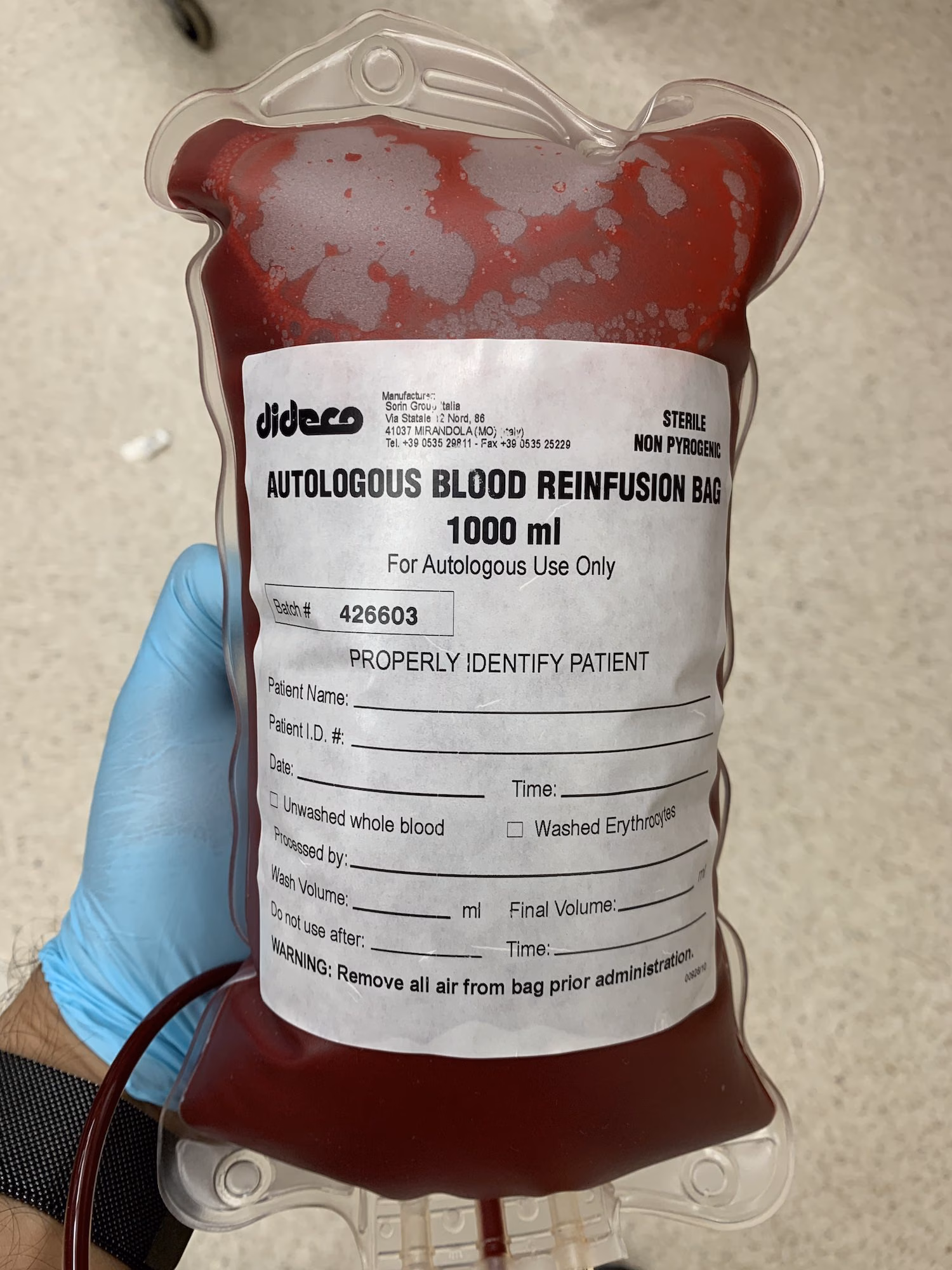 Autologous Blood Donation And Platelet Rich Plasma