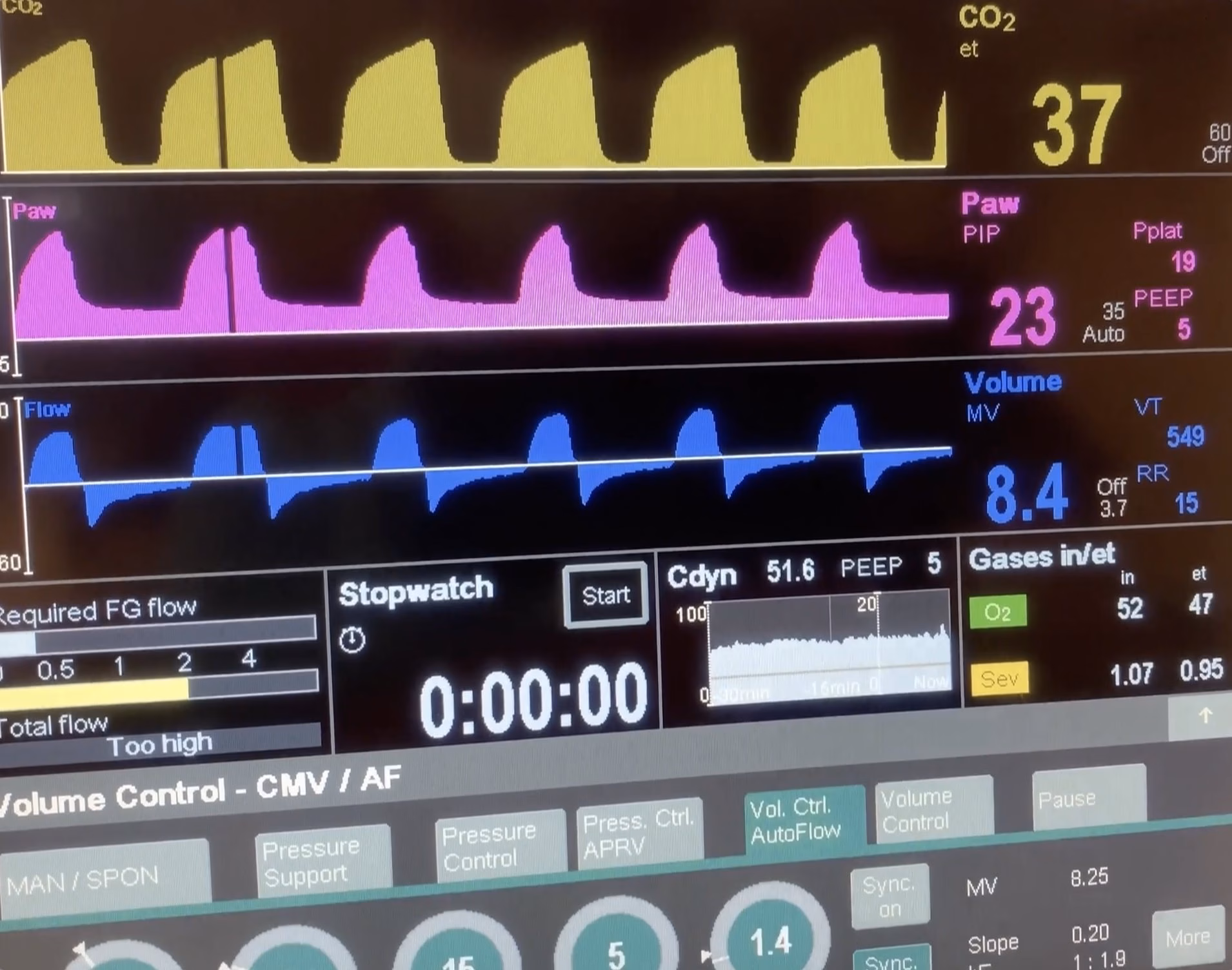 Volume Control (VC) Versus Volume Control Auto Flow (VC-AF)