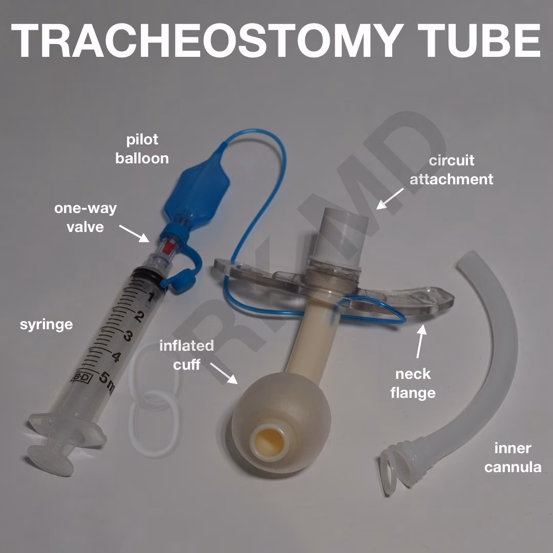 Tracheostomy Dislodgment