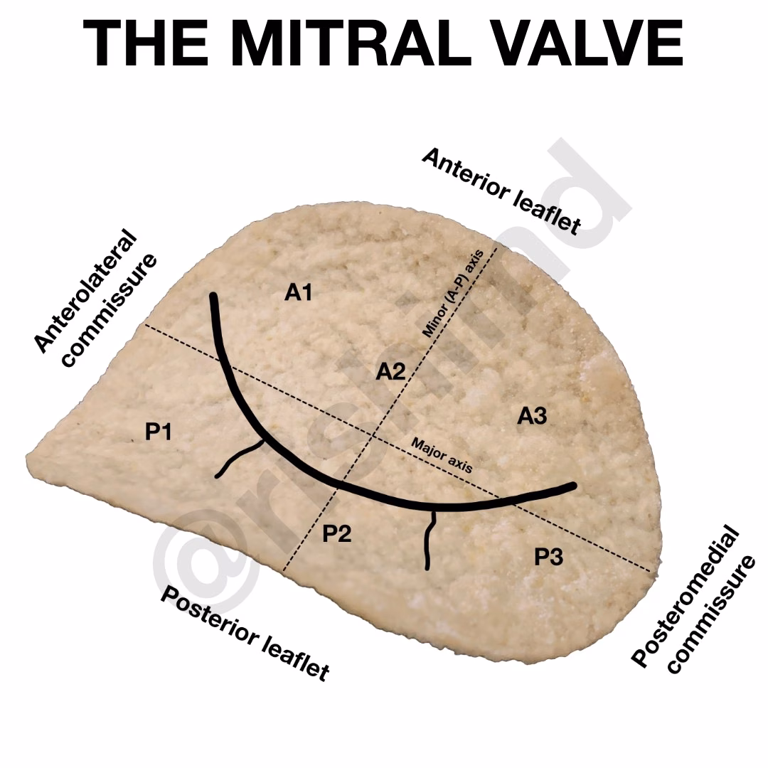 The Pringles Mitral Valve