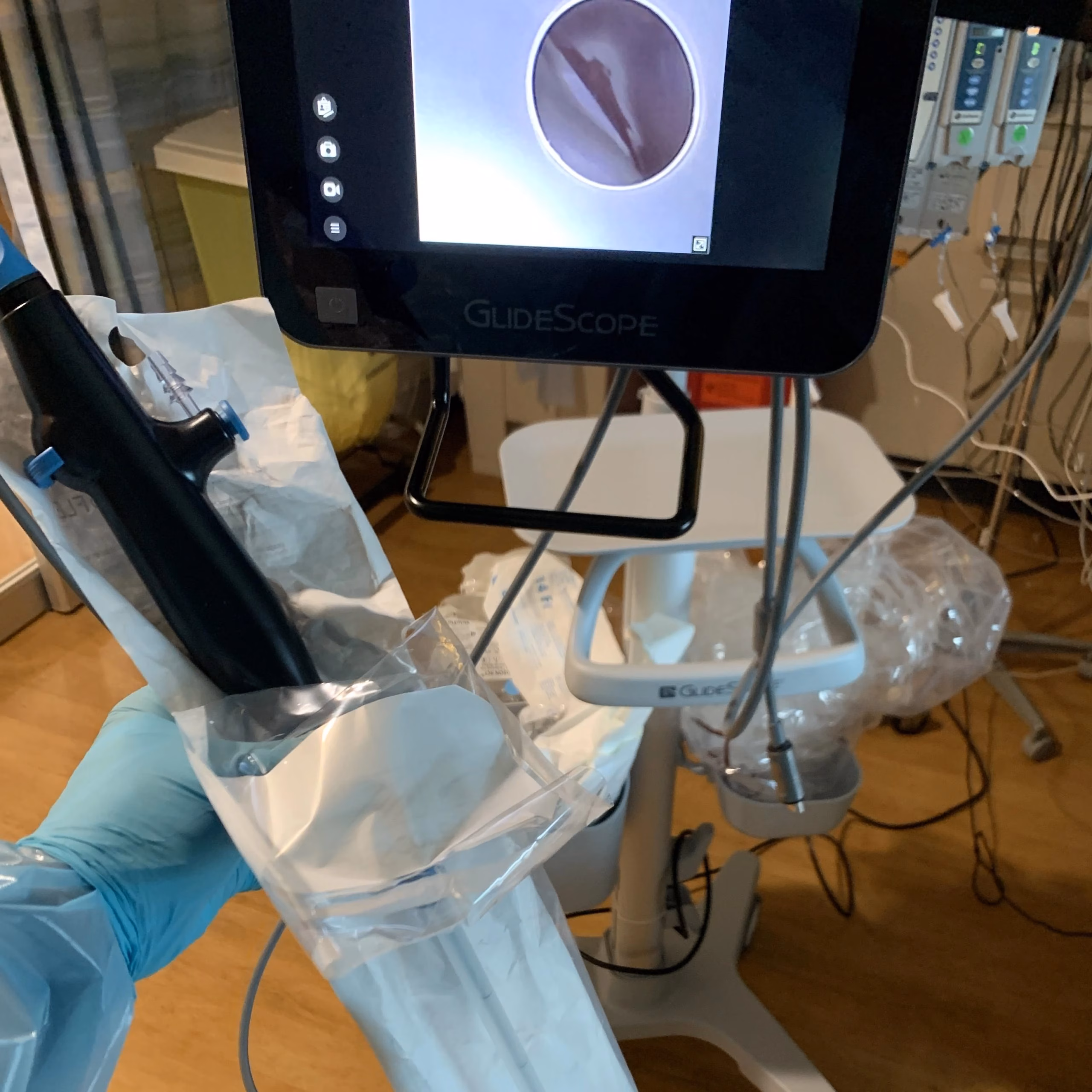 Bronchoscopy Procedure Note Template
