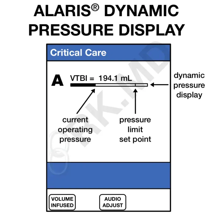 alaris-pump-dynamic-pressure-display-rk