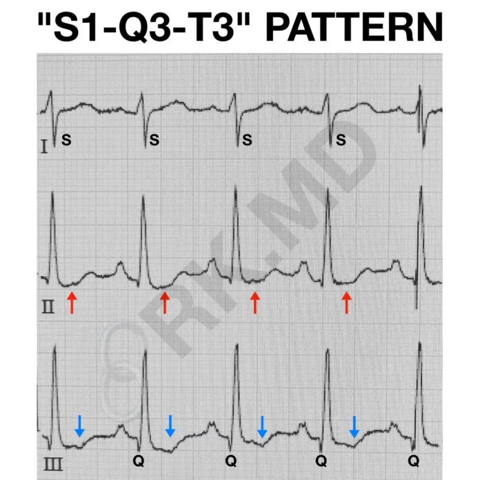 ekg-s1-q3-t3-rk