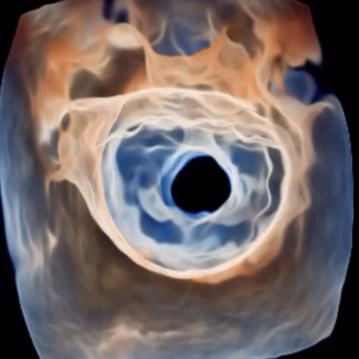 Tendyne Transcatheter Mitral Valve Replacement (TMVR)