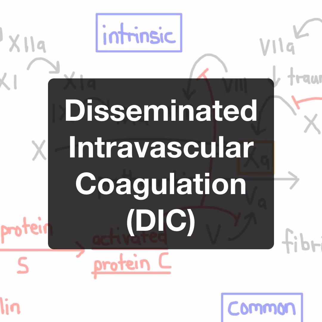 Disseminated Intravascular Coagulation (DIC)