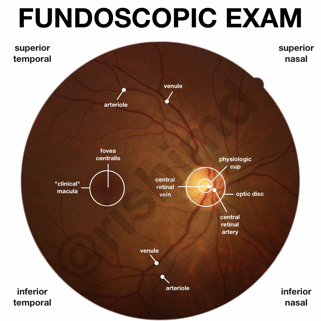 Fundoscopic Examination