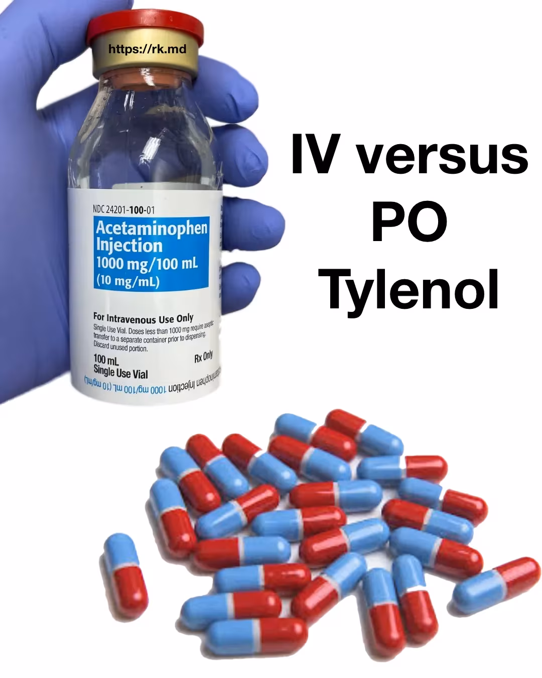 IV Versus PO Acetaminophen (Tylenol)