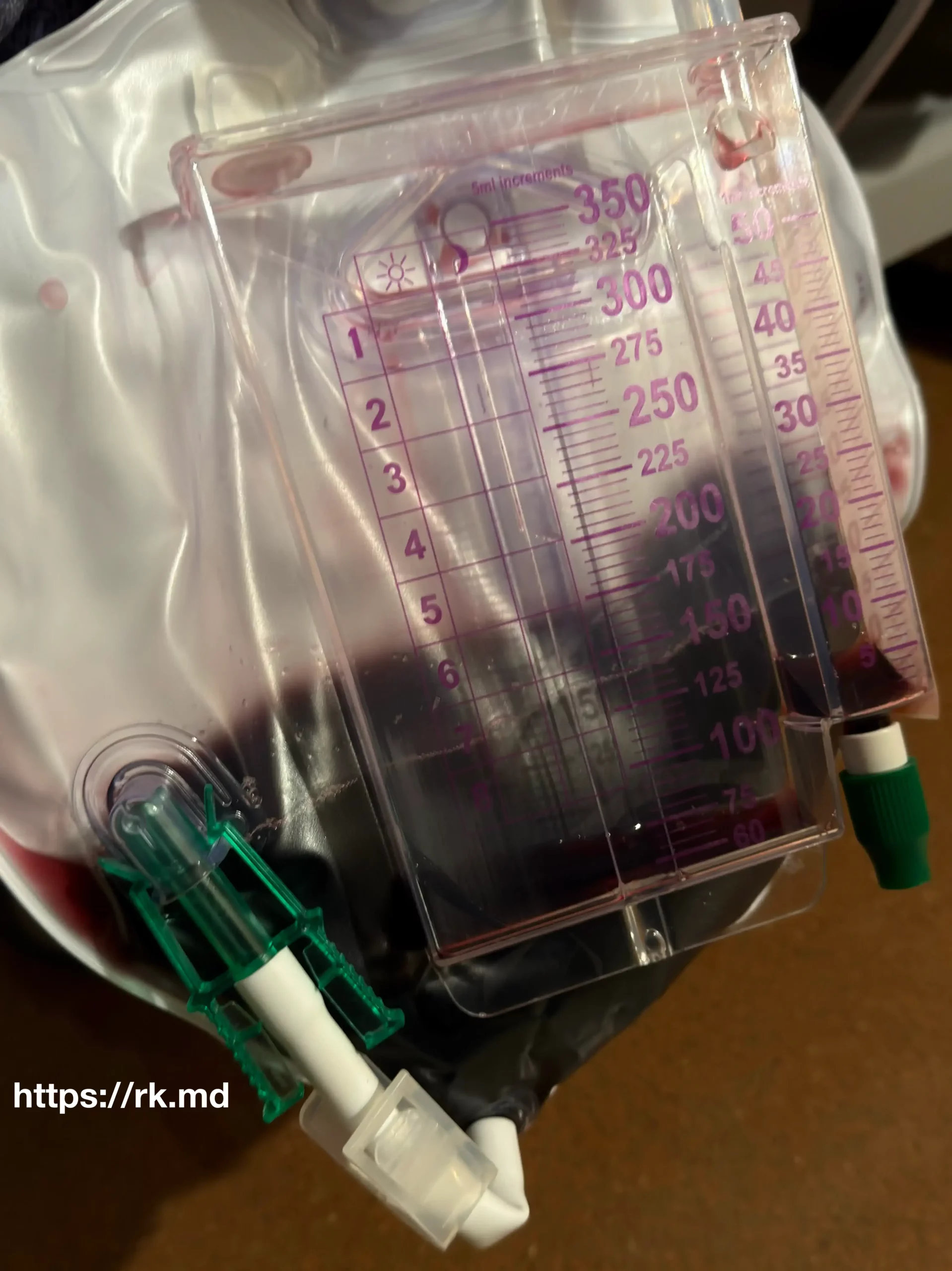 Hydroxocobalamin vs. Methylene Blue for Vasoplegia After Cardiac Surgery